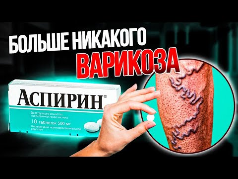 Видео: Хитрость бабушки по удалению варикозного расширения вен всего за неделю!