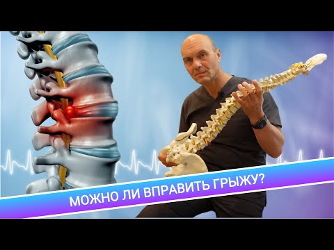 Видео: МОЖНО ЛИ ВПРАВИТЬ ГРЫЖУ? (Нет)