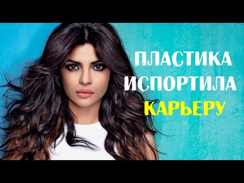 Видео: Как неудачная пластика Приянки Чопры едва не стоила ей карьеры