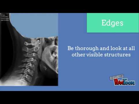 Видео: Подход к рассмотрению рентгенограмм шейного отдела позвоночника