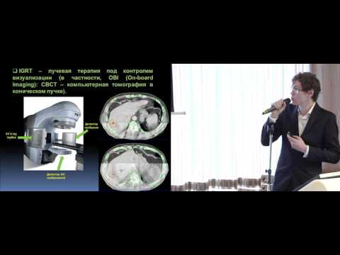Видео: Стереотаксическая радиотерапия в лечении больных колоректальным раком с метастазами в печень