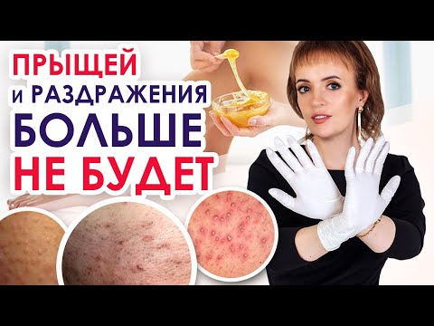 Видео: Уход за кожей после депиляции | Вросший волос и прыщи на лобке больше не появятся