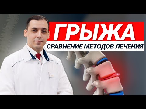 Видео: АРМДИС vs ФИЗИОТЕРАПИЯ | Сравнение методов лечения ГРЫЖ в позвоночнике.