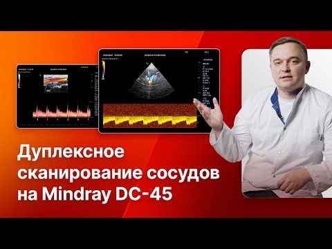 Видео: Дуплексное сканирование сосудов шеи, головного мозга, брюшной аорты и ветвей на Mindray DC-45