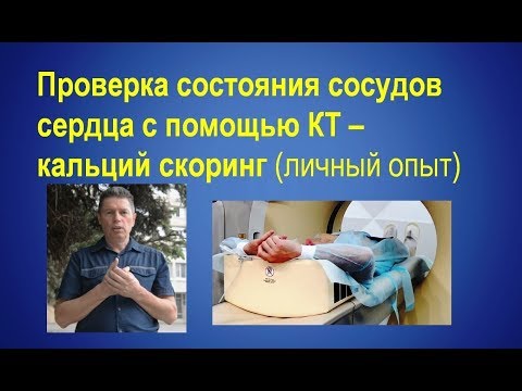 Видео: Проблемы с сердцем  и индекс Агатстона