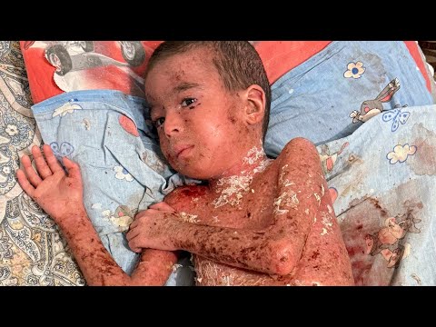Видео: ДАХШАТ КУРИБ ЙИГЛАЙСИЗ БОЛАКАЙ НИМА УЧУН БУ АХВОЛДА ХАМА КУРСИН