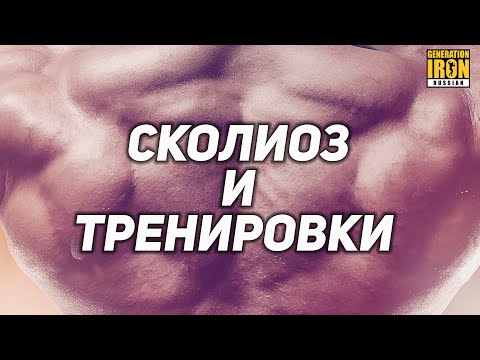 Видео: СКОЛИОЗ И ТРЕНИРОВКИ