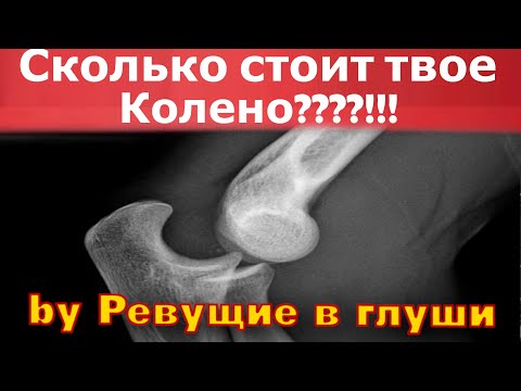 Видео: Лучшие наколенники В МИРЕ! Брейсы для снегохода и эндуро Yami Customs ями кастомс