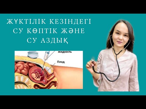 Видео: Жүктілік кезіндегі су көптік және су аздық/Қағанақ суының аз болуы/Многоводие при беременности