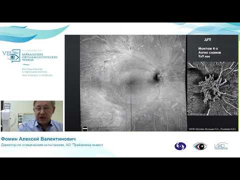 Видео: «Cовременные технологии диагностики патологий заднего отдела глаза» Сателлитный симпозиум