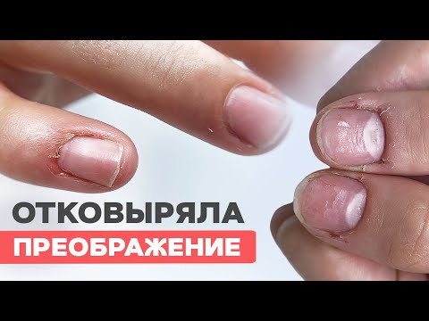 Видео: Как сделать наращивание ногтей | Верхние формы