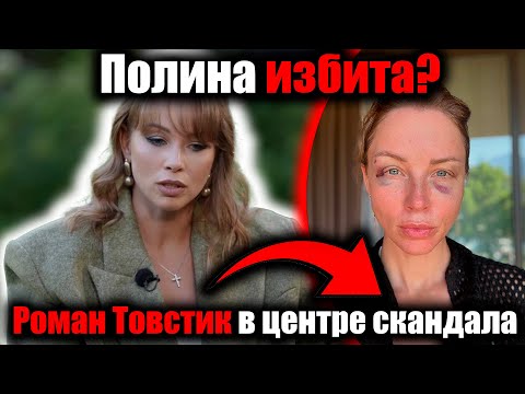 Видео: «Полина Диброва избита? Синяк и тайна отношений с Товстиком взорвали сеть»