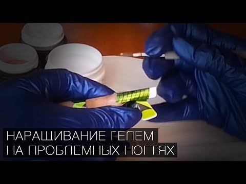 Видео: Наращивание гелем на проблемных ногтях (трапециевидные глубоко посаженные ногти): практика / Маникюр
