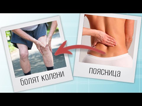 Видео: Боль в двух коленях сразу? Причина в пояснице | изПРАКТИКИ