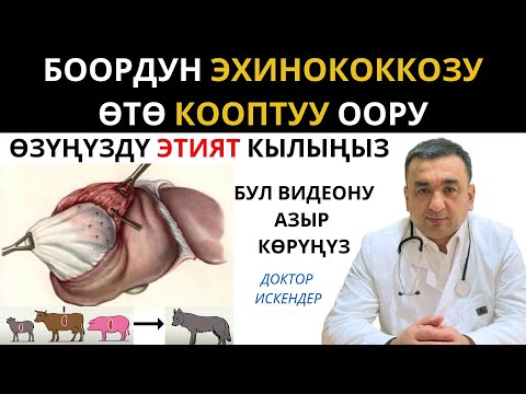 Видео: БООРДУН ЭХИНОКОККОЗ ООРУСУ ӨТӨ КООПТУ ООРУ / БУЛ ВИДЕОНУ ТЕЗ КӨРҮҢҮЗ / ЭХИНОКОККОЗ ООРУСУ