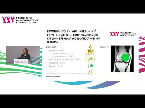 Видео: Оценка эффективности терапии деносумабом гигантоклеточной опухоли кости по данным лучевых методов