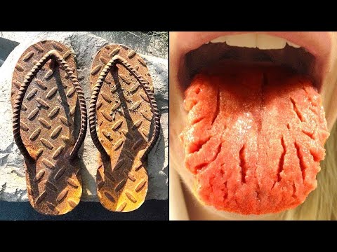 Видео: Фотографии, Которые Вызывают Дискомфорт