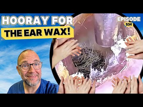 Видео: УРА ушной сере! Эпизод 534