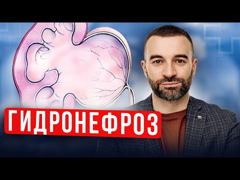 Видео: Гидронефроз у ребенка. Что за болезнь? Как выявить и вылечить?