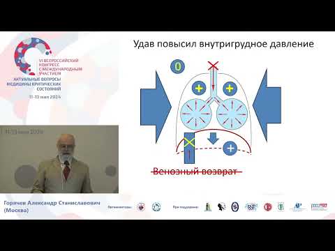 Видео: Кардио респираторное взаимодействие пациента на ИВЛ Горячев А.С.