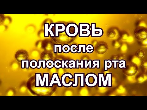 Видео: Кровь после полоскания рта маслом