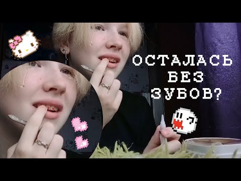 Видео: КАК ОСТАТЬСЯ БЕЗ ЗУБОВ?/скайсы дома/