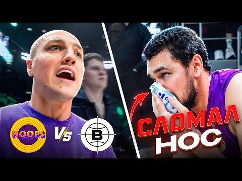 Видео: HOOPS vs BLATOSPHERA / ИГРОКУ СЛОМАЛИ НОС !