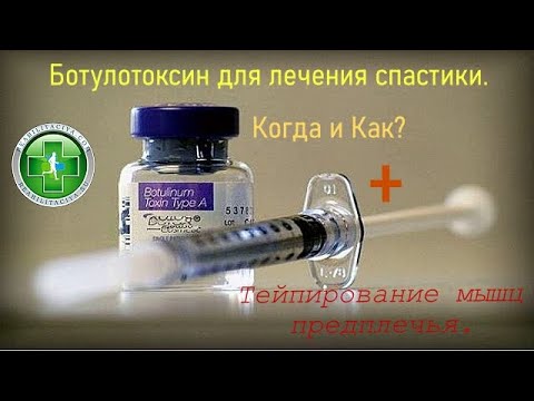 Видео: Ботулотоксин для лечения спастики после инсульта. Кинезиотейпирование мышц предплечья.