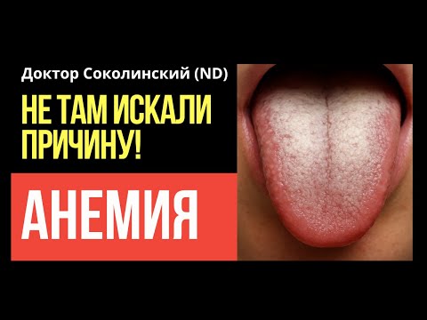 Видео: Не просто газы в животе: как кишечная Candida приводит к анемии