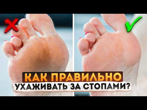 Видео: Полезные советы для красивых и здоровых стоп! Что можно делать, а что нельзя?