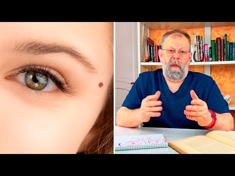 Видео: Кератомы вокруг глаз. О чем нужно знать?
