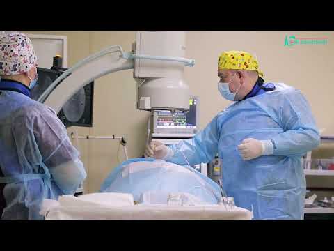 Видео: Радиочастотная абляция позвоночника