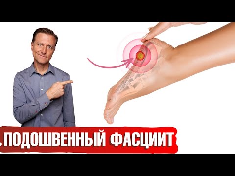 Видео: Боль в ступне: что делать? Плантарный фасциит 👉 есть решение