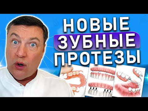 Видео: Протезы зубов НОВЫЕ технологии