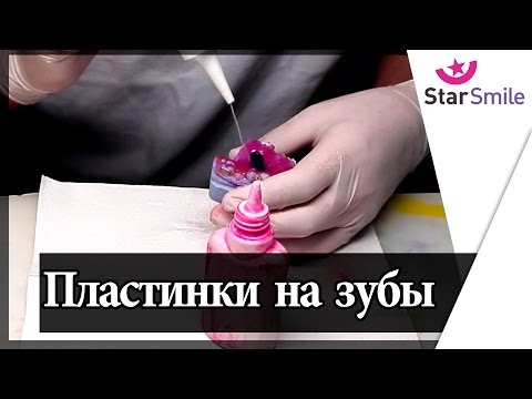 Видео: Изготовление пластинки для расширения челюсти -  старые технологии лечения прикуса