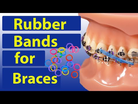 Видео: Резинки (эластичные) для брекетов — Руководство по брекетам