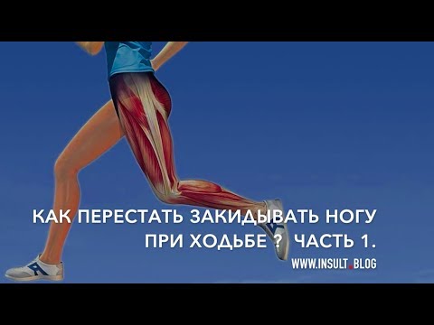 Видео: Как перестать "закидывать" ногу при ходьбе? Часть 1