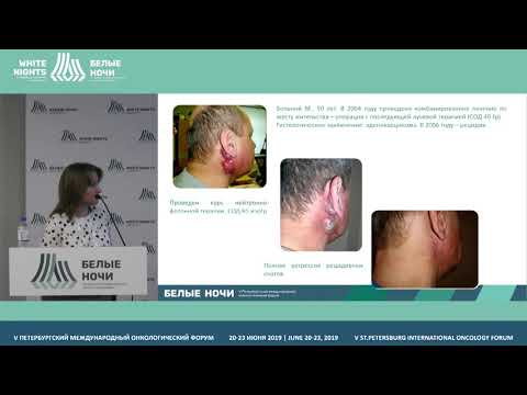 Видео: Возможности нейтронной терапии в лечении рецидивных опухолей головы и шеи (Грибова О.В.)