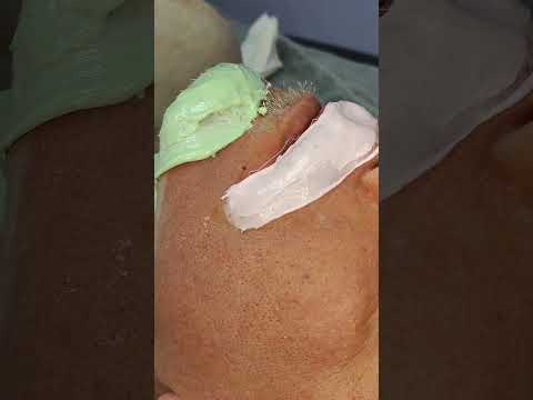Видео: Депиляция мужской бороды!