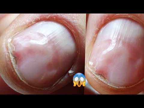 Видео: Зверски ПЕРЕПИЛЕНЫ ногти😢как укрепить истонченные ногти ? Укрепление для слабых ногтей