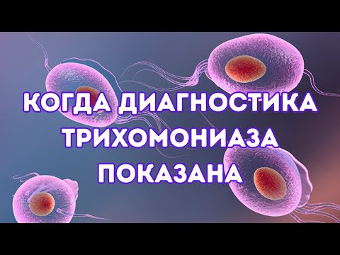 Видео: Когда показана диагностика трихомониаза #трихомониаз #трихомонады #doctorberezovska