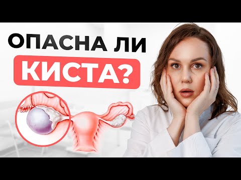 Видео: Киста яичника – это РАК? Что НЕЛЬЗЯ делать и когда СРОЧНО к врачу? Вся правда о причинах и лечении