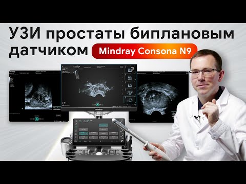 Видео: Мастер-класс на Mindray Consona N9. Как получить четкое изображение на УЗИ простаты?