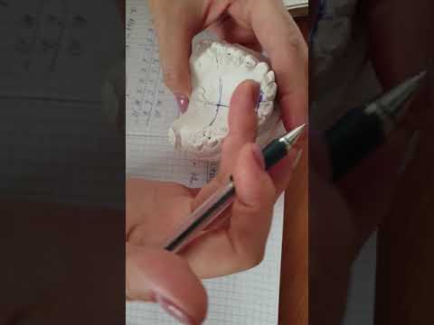 Видео: Метод Коргхауза