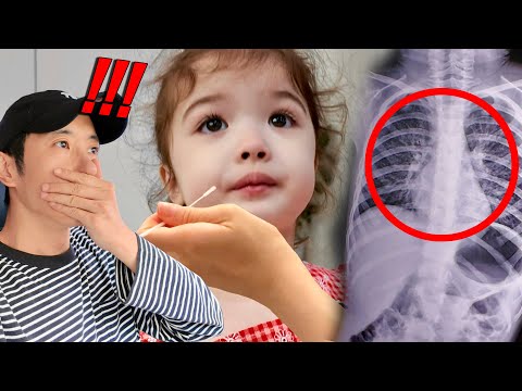 Видео: SUB) Моя двухлетняя дочь попала в больницу с пневмонией из-за моей ошибки | VLOG