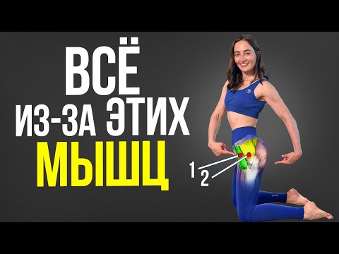 Видео: Коксартроз, боли в тазобедренном суставе, коленях, пояснице и всё из-за ЭТИХ 2-х мышц