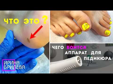 Видео: ЧТО ЭТО на пятке ??? 😱 ЧТО СЛУЧИЛОСЬ с моим педикюрным аппаратом? 🌸 Педикюр 🌸 Ирина Брилёва