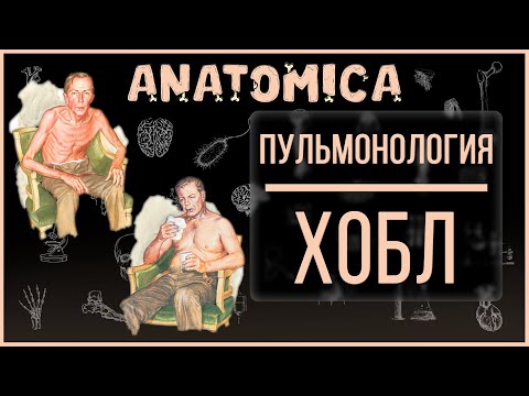 Видео: ХОБЛ / Хроническая обструктивная болезнь легких / Эмфизема и хронический бронхит / Пульмонология