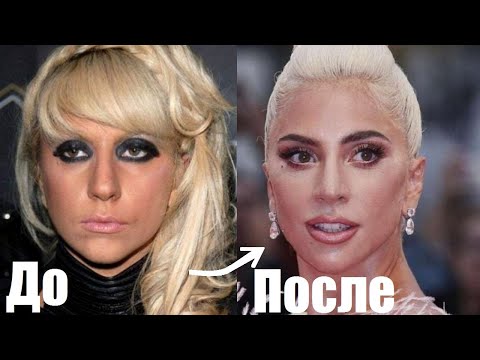 Видео: ЛЕДИ ГАГА | ЧТО она с собой СДЕЛАЛА | Пластика и косметология