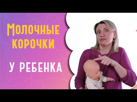 Видео: Молочные корочки у ребенка: что это и как удалить?